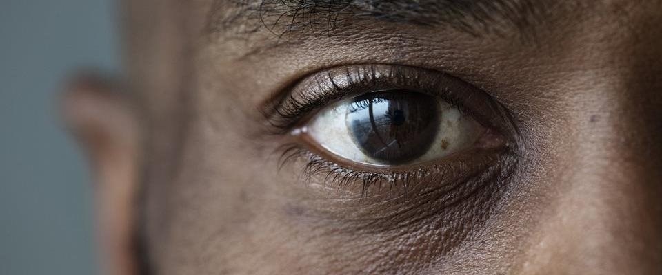 CLINICAL FILES: Case on a patient refusing to see a certain optometrist